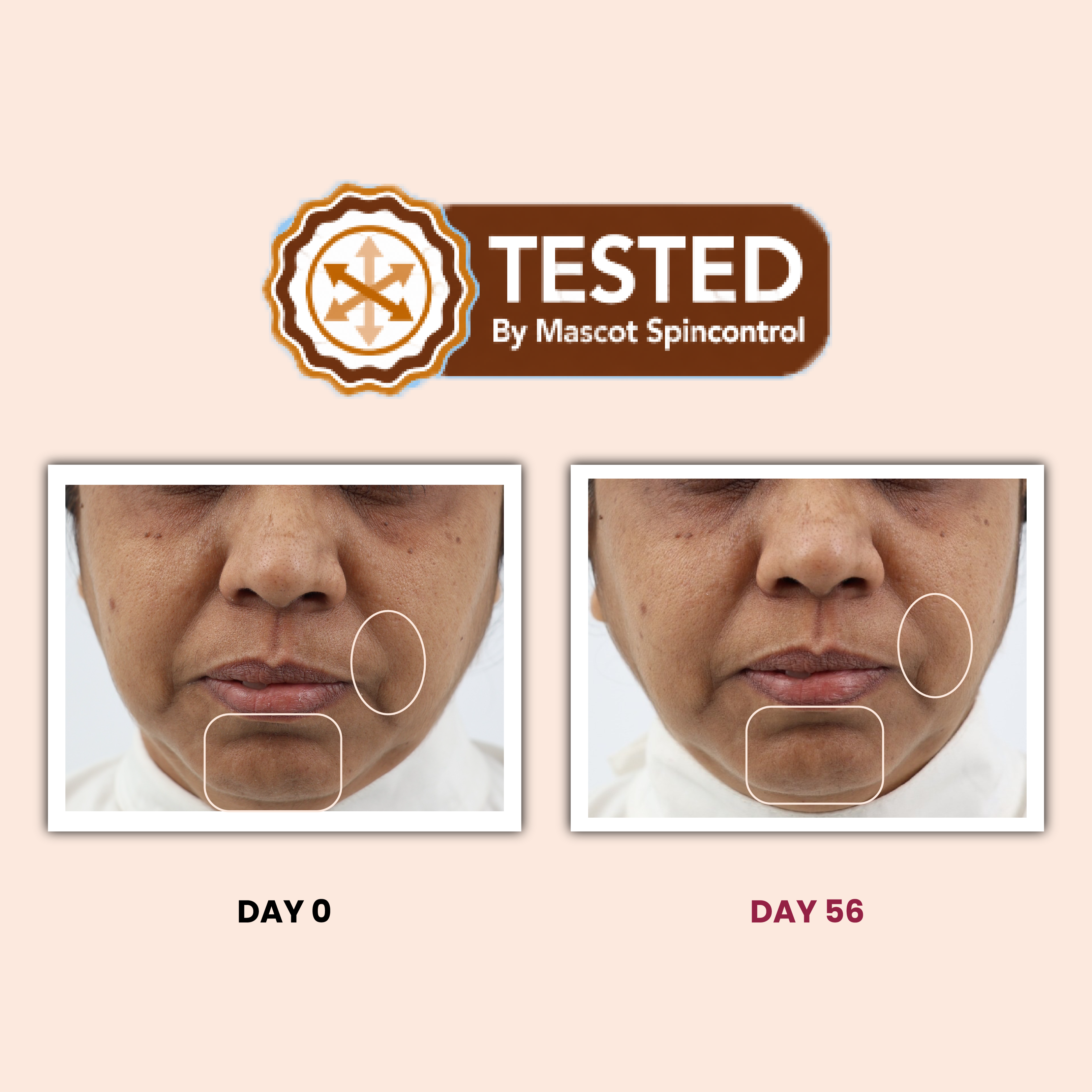 Spincontrol Tested Day 0 Day 56