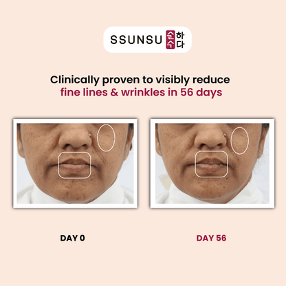 Niacin·Ginseng Serum | Korean Niacinamide Face Serum – 30ml